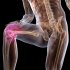 Остеоартрит коленного сустава опасен для всех!