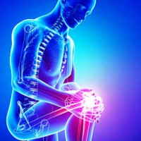 Методы лечения надрыва связок коленного сустава