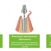 Почему голос котенка вызывает такую симпатию? Давайте разберемся!