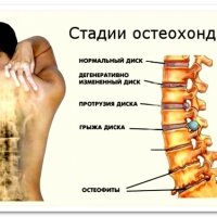 Биосенсорные пластины: новое слово в медицинской диагностике