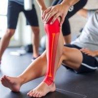 Реабилитация после пластики ПКС: этапы и типичные ошибки, которые стоит знать