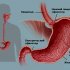 Недостаточность пилоруса желудка: причины, симптомы и способы лечения
