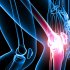 Как проявляется воспаление коленного сустава?