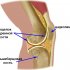Анатомия и травмы мыщелка коленного сустава