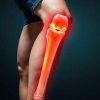 Укорочение конечности из‑за поражения колена: причины и коррекция