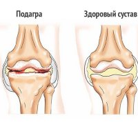Признаки того, что ребенок проглотил инородный предмет