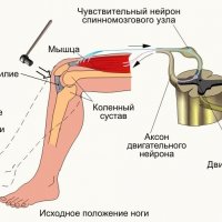 Как коленный рефлекс помогает в диагностике?
