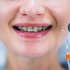 Ортодонтическое лечение: важность красивой улыбки и здоровья челюстно-лицевой области