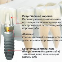 Тайны таинственного Tapinauchenius plumipes: познакомьтесь с удивительным пауком-коллегой