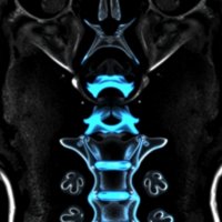 МРТ шейного отдела с контрастом: что это такое и как к нему подготовиться без паники