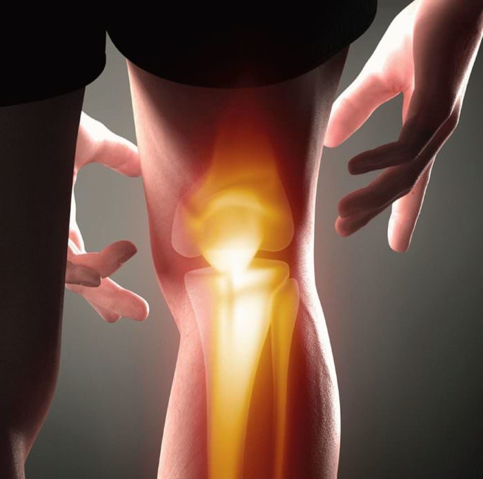 Артроз коленного сустава симптомы диагностика и лечение