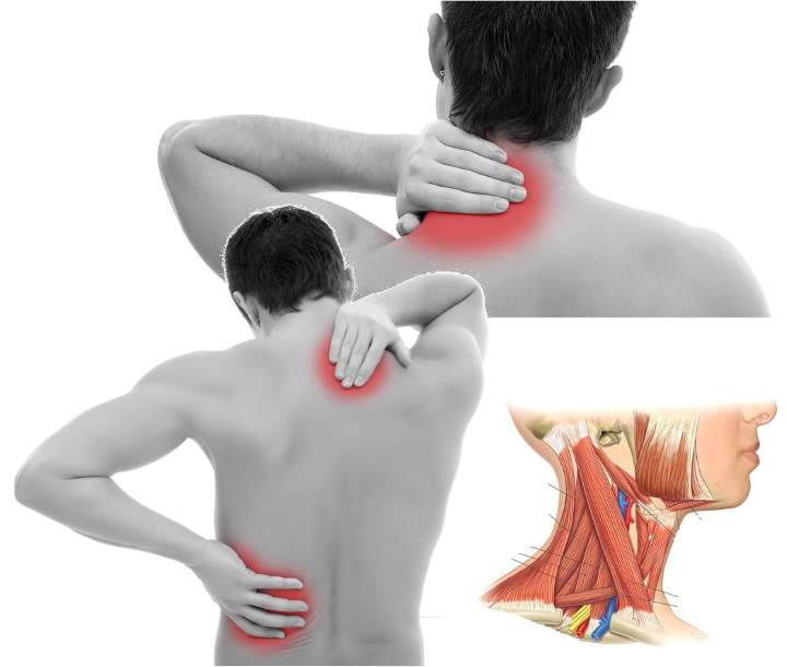 Миозит мышц спины: симптомы и лечение